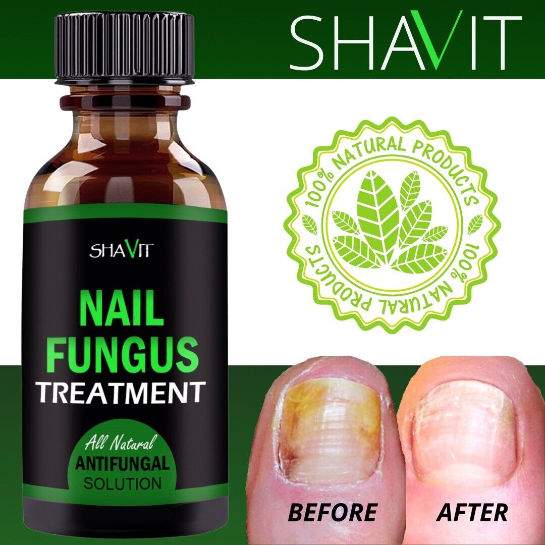 ANTI FUNGAL TREATMENT