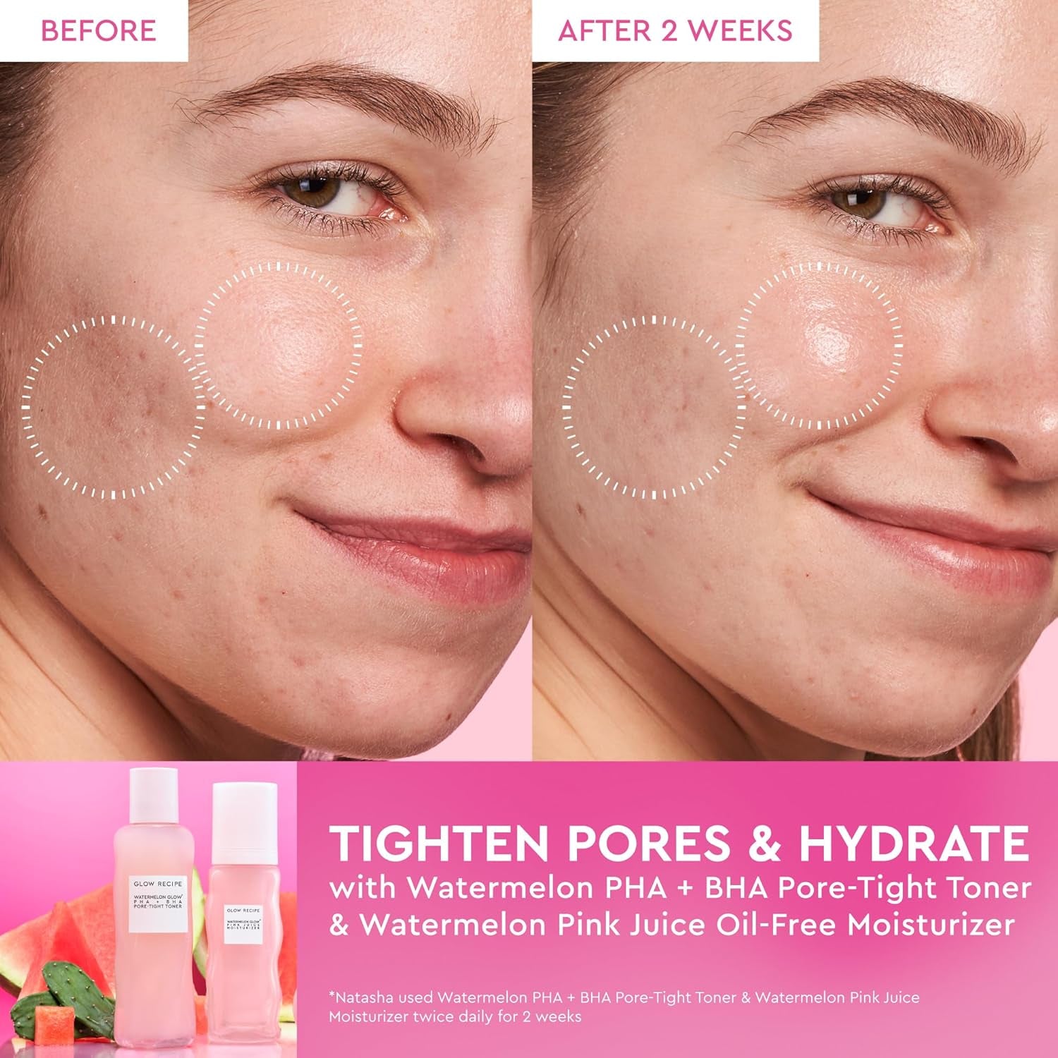 PHA + BHA Face Toner, Korean Exfoliating Toner for Pores, Gentle Chemical Exfoliant + Hydrating Toner, Watermelon, Cactus Water + Glycerin (150Ml)