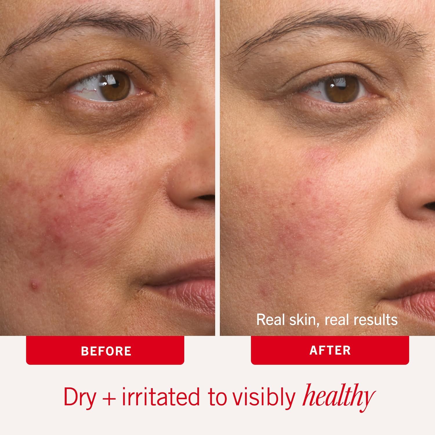 - Ultra Repair Cream - Intense Hydration Face & Body Moisturizer - Whipped Colloidal Oatmeal Clinically Proven to Strengthen Skin Barrier in 7 Days - Helps Relieve Eczema, 6 Oz