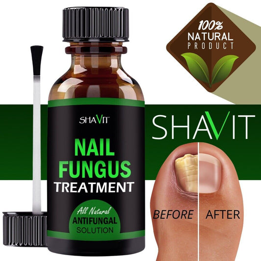 ANTI FUNGAL TREATMENT