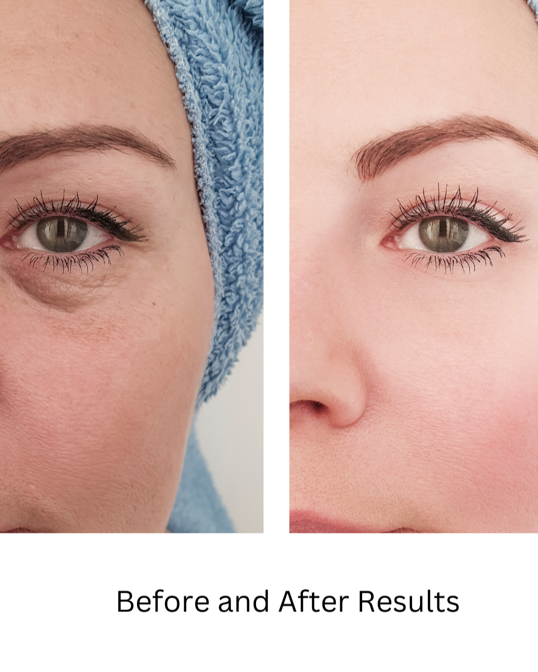 Organic Under Eye Youth Corrector – Dark Circles, Puffiness & Wrinkle Cream