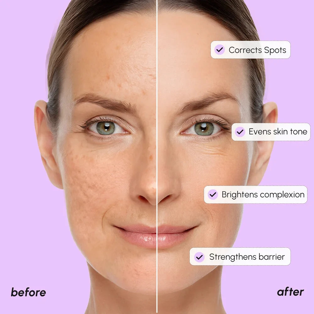 Marée® Tranexamic Acid Dark Spot Corrector | Brightening Serum for Dark Spots & Uneven Skin Tone
