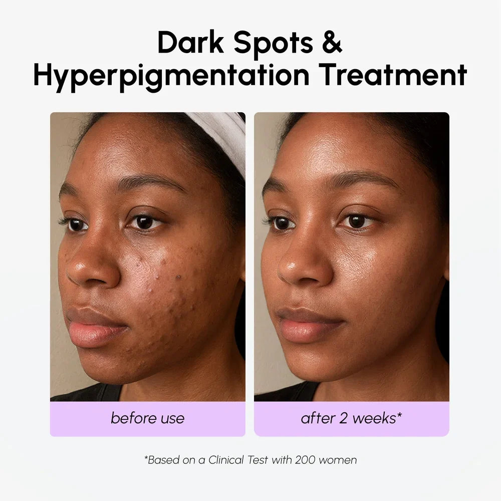 Marée® Tranexamic Acid Dark Spot Corrector | Brightening Serum for Dark Spots & Uneven Skin Tone