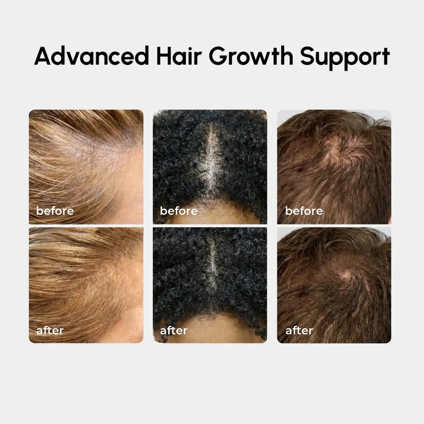 Marée® 4-in-1 Hair Growth Spray | Scalp Treatment for Fuller, Stronger-Looking Hair
