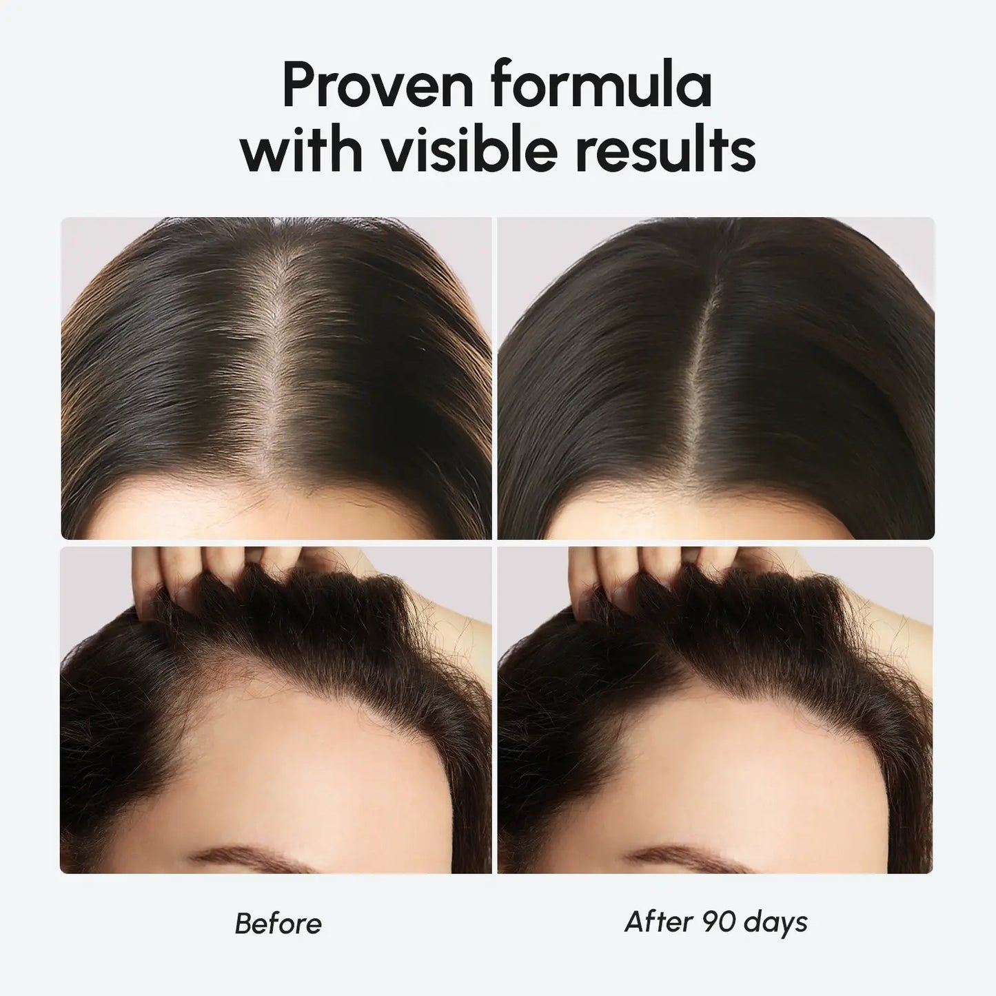 Biotin & Collagen Hair Growth Complex | Thicker, Stronger, Healthier Hair Support