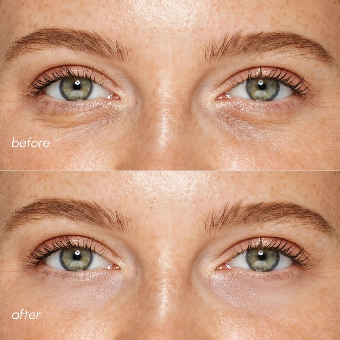MAREE Pink Eye Gels - Marine Collagen Under Eye Patches for Puffy Eyes and Dark Circles