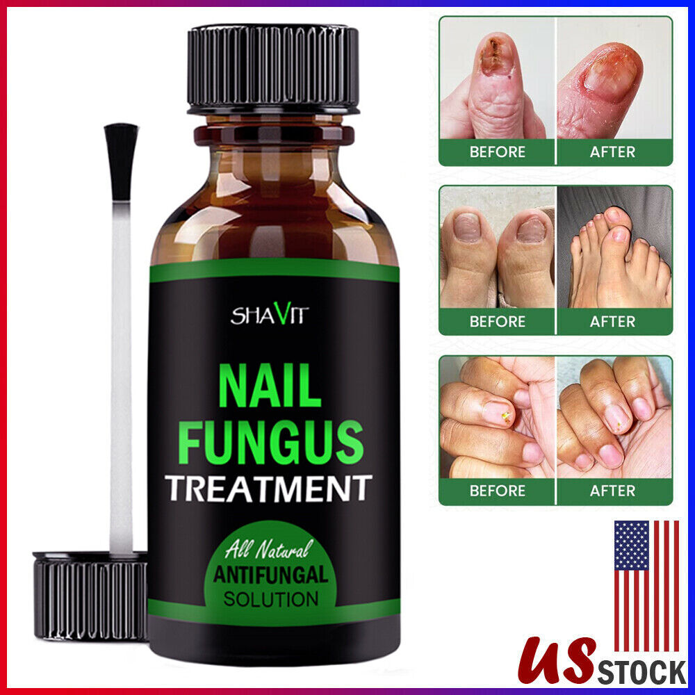 ANTI FUNGAL TREATMENT