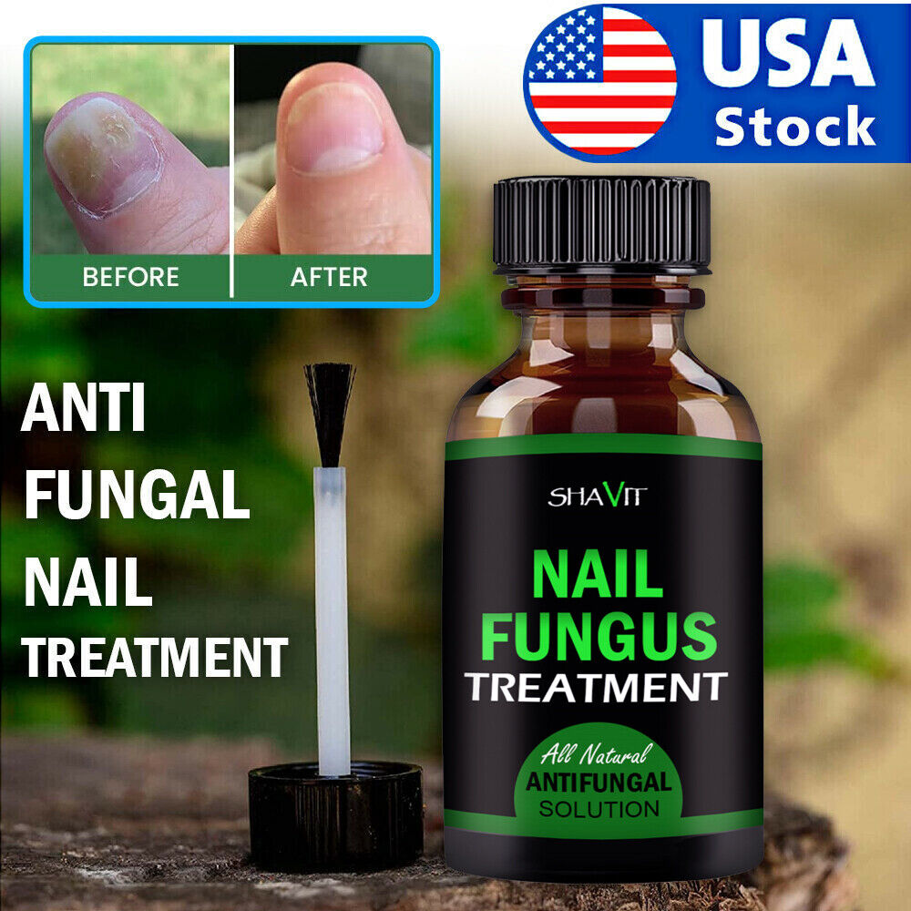 ANTI FUNGAL TREATMENT