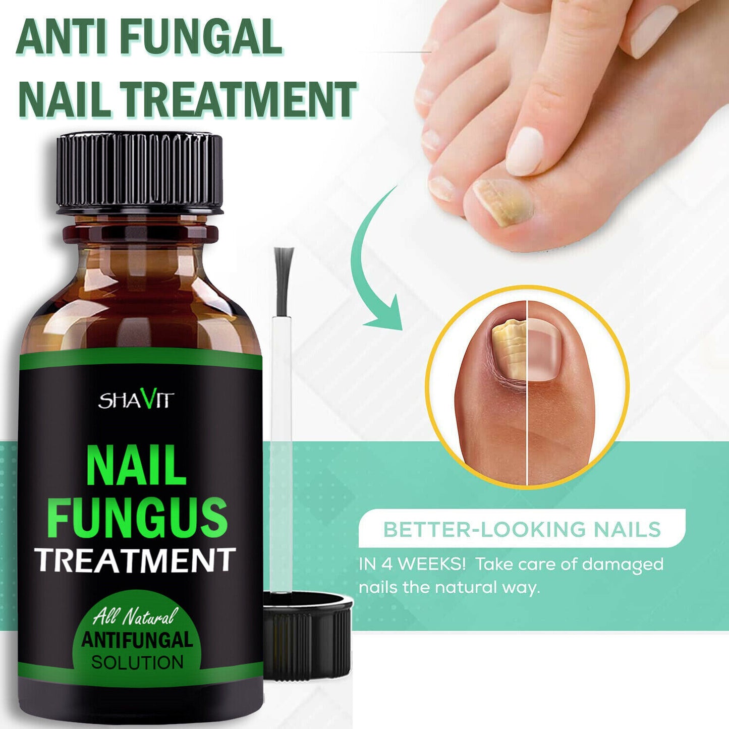 ANTI FUNGAL TREATMENT